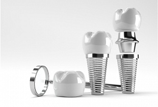 Имплантация зубов