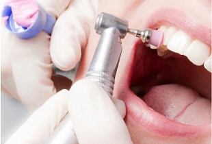 Гигиена полости рта